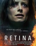 Retina